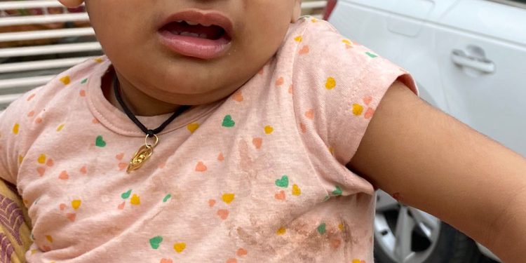 ग्रेटर नोएडा में कुत्तो का आतंक, मासूम बच्चो को कुत्ते ने घसीट कर किया घायल, देखे सीसीटीवी