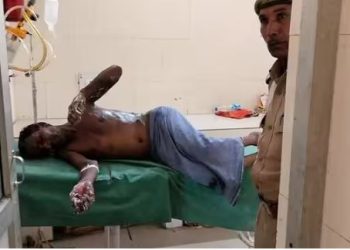 बीच सड़क पर पिता को डीजल छिड़ककर लगाई आग