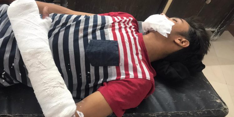 प्रेमिका से मिलने घर पहुंचे युवक के साथ परिजनों ने की मारपीट, गंभीर हालत में अस्पताल में भर्ती