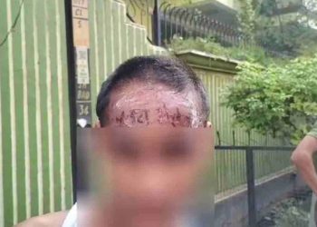 क्रूरता की हद! मुस्लिम लड़के के माथे पर चाकू से गोदा ‘जय भोलेनाथ’, जिसने की हरकत वो था…