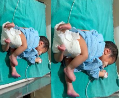 चार पैर, तीन हाथ… यूपी के मेरठ में पैदा हुए इस बच्चे को देखकर डॉक्टर भी हैरान