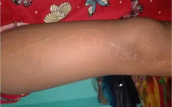 बच्ची के शरीर पर उभर रहा कभी राम-राम तो कभी राधे-राधे, कभी देवी-देवताओं के नाम, हर कोई हैरान
