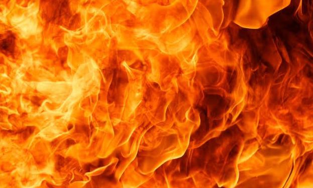 गांव के दबंगों ने पेट्रोल छिड़क बाबा को जिंदा जलाया, हालत नाजुक; सामने आई ये वजह