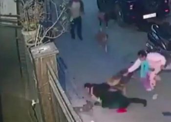 पालतू कुत्ते ने बच्चे को नोचा, जबड़े में जकड़ लिया पैर; मासूम को बचाने के चक्कर में सड़क पर गिर गई मां