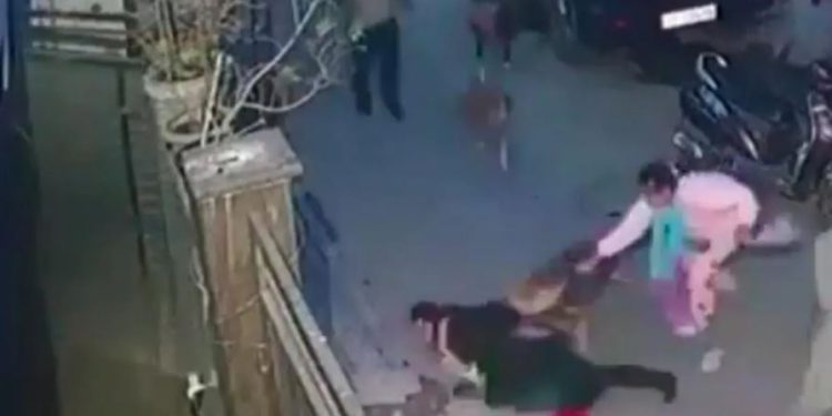 पालतू कुत्ते ने बच्चे को नोचा, जबड़े में जकड़ लिया पैर; मासूम को बचाने के चक्कर में सड़क पर गिर गई मां