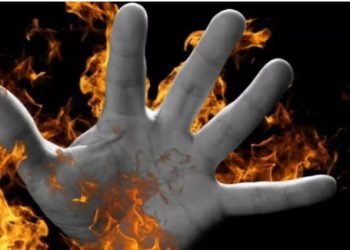 सिरफिरे आशिक के एकतरफा प्यार से परेशान हुई ममेरी बहन, घर बुलाकर युवती ने जिंदा जलाया