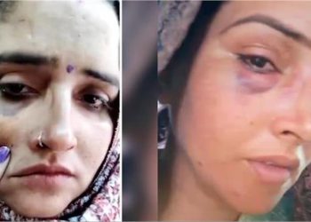 Seema Haider ने अपने चेहरे पर दिखाए जख्मों के निशान, क्या पति सचिन ने कर दी मारपीट? वकील ने बताई पूरी सच्चाई