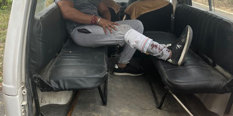 पुलिस मुठभेड़ में रणदीप भाटी गैंग का बदमाश हुआ घायल, पिस्टल, कारतूस और कार बरामद