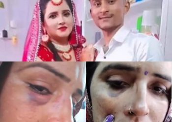 सीमा हैदर की अपने साथ मारपीट के जख्म दिखाते हुए सोशल मीडिया पर वीडियो हुई वायरल