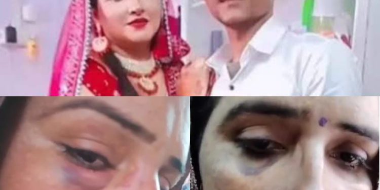 सीमा हैदर की अपने साथ मारपीट के जख्म दिखाते हुए सोशल मीडिया पर वीडियो हुई वायरल