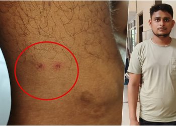 यूपी के विकास द्विवेदी को 8वीं बार सांप ने डसा, 500 Km दूर भी पहुंच गया ‘दुश्मन’; अब पिता को आया खतरनाक सपना