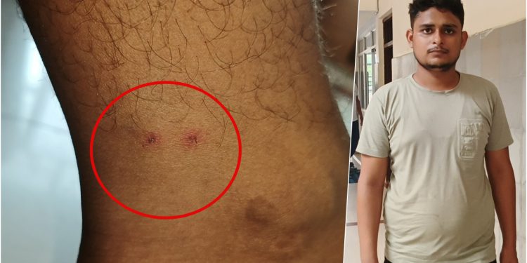 यूपी के विकास द्विवेदी को 8वीं बार सांप ने डसा, 500 Km दूर भी पहुंच गया ‘दुश्मन’; अब पिता को आया खतरनाक सपना