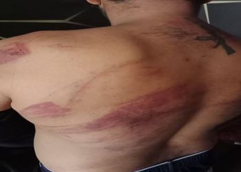 मेरठ में अधिवक्ता को नग्न कर पीटा, पानी में मिलाकर पेशाब पिलाया; दोस्तों को वीडियो कॉल कर दिखाई पिटाई