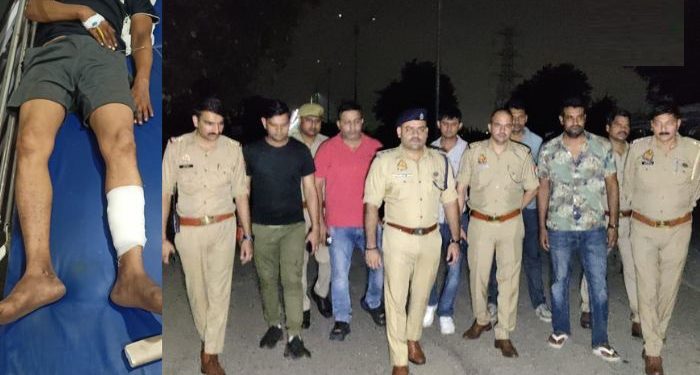 नोएडा पुलिस ने मुठभेड़ में 25000 के इनामी बदमाश को किया लंगड़ा