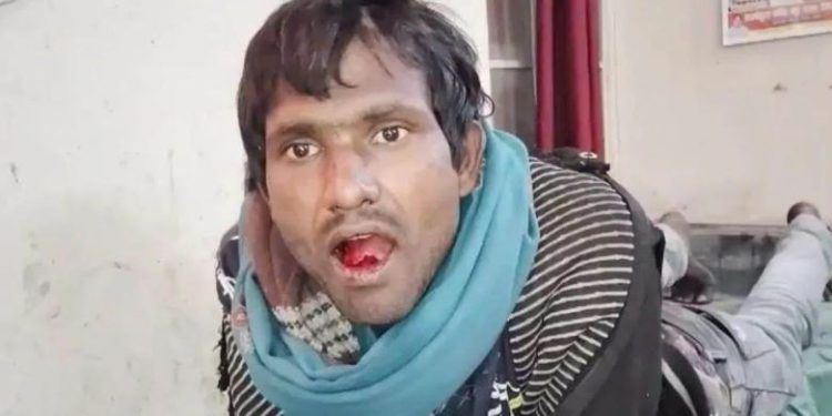 घर में सो रही थी महिला, तभी युवक जाकर करने लगा ये हरकतें; शोर मचाया तो अपनी जीभ काटकर कूड़े में फेंक डाली