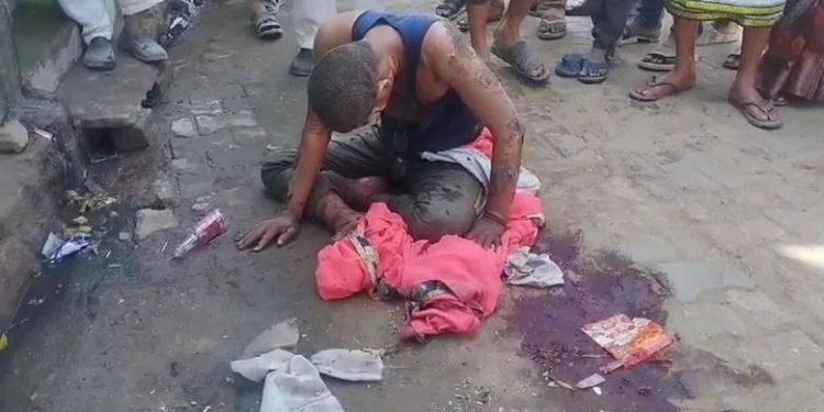 प्रेमिका के घर लहंगा पहनकर पहुंचा, दोनों में हो गई लड़ाई; प्रेमी ने पेट्रोल डालकर लगा दी आग…हालत गंभीर