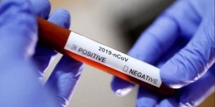 दिल्ली में सामने आए कोरोना के 81 मामले, दो मरीजों की मौत