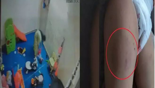 थप्पड़ मारे, बेल्ट से पीटा, जमीन पर पटका, जी नहीं भरा तो दांत से भी काटा… नोएडा के डे केयर में 15 महीने की बच्ची के साथ बर्बरता