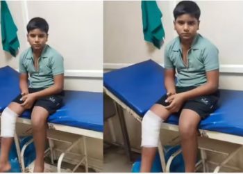 ग्रेटर नोएडा में स्कूल से घर लौट रहे बच्चे पर पागल बंदर ने किया हमला, अस्पताल में इलाज जारी, इलाके में दहशत